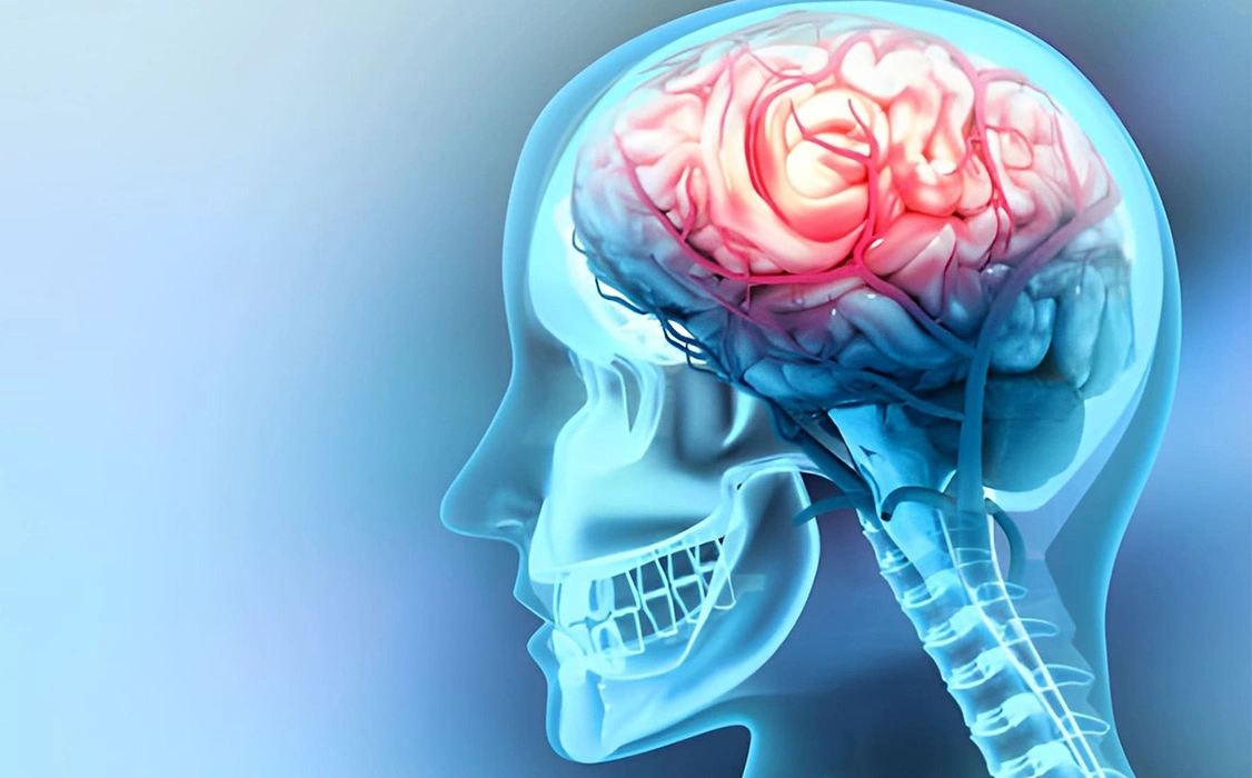 What is Functional Neurosurgery