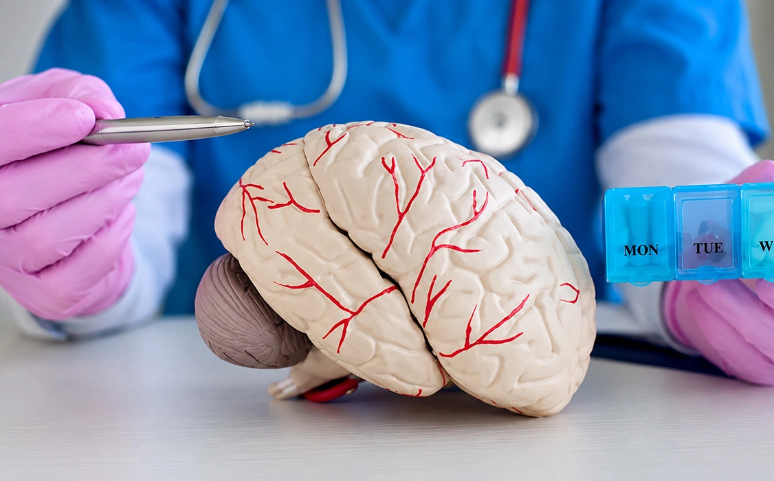 Diagnosis for Brain Aneurysm