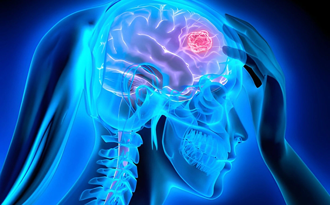 Diagnosis Before Skull Base Surgery