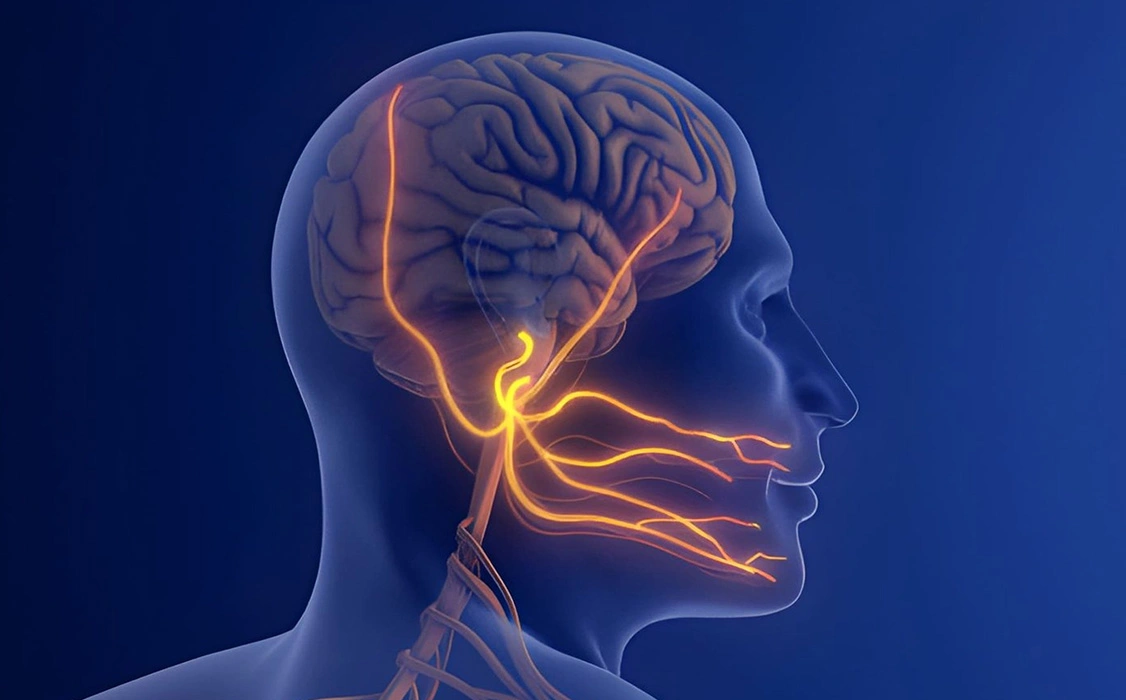 Diagnosis for Trigeminal Neuralgia