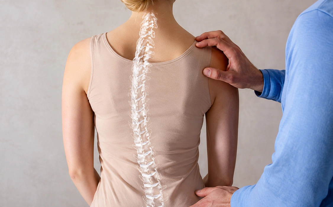 What is Scoliosis