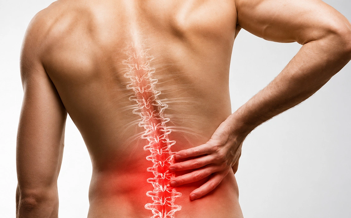 What are Spondylolysis and Spondylolisthesis