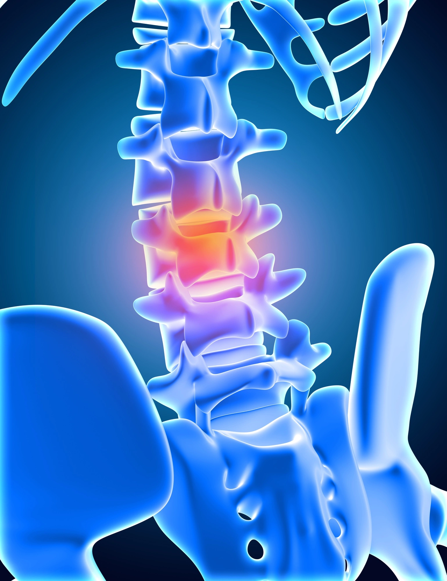 Diagnosis Before Endoscopic Disc Surgery